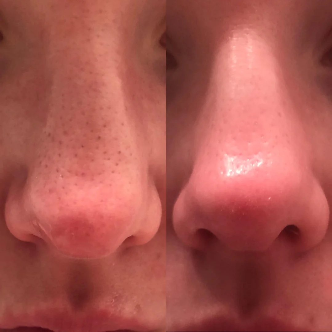 Dr. Melaxin Rice Skin Serum