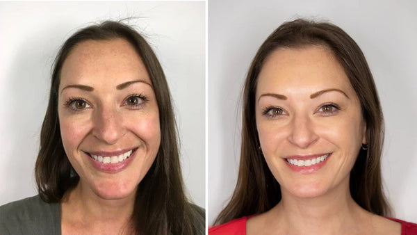 Seoul 1988 Anti-Aging