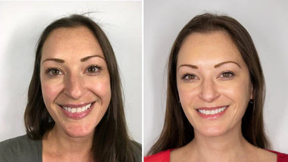 Seoul 1988 Anti-Aging