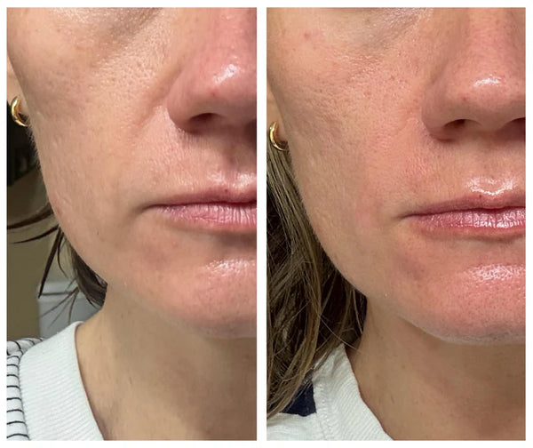 Seoul 1988 Anti-Aging