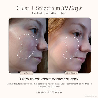 Skin Therapy - High Frequency Wand