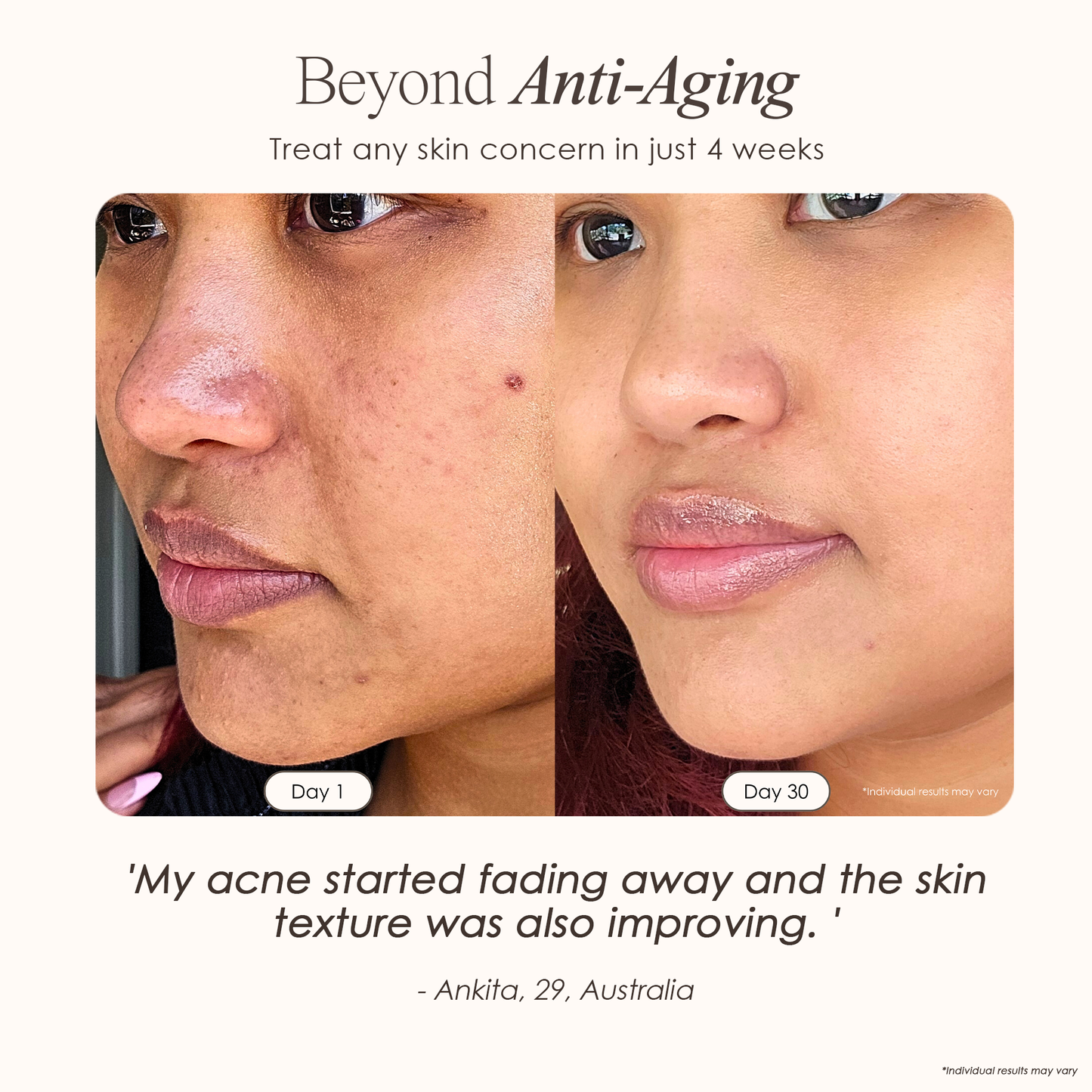 Skin Therapy - High Frequency Wand