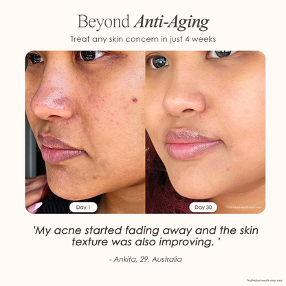 Skin Therapy - High Frequency Wand