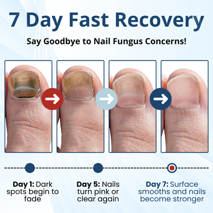 Fungal Nail Patches