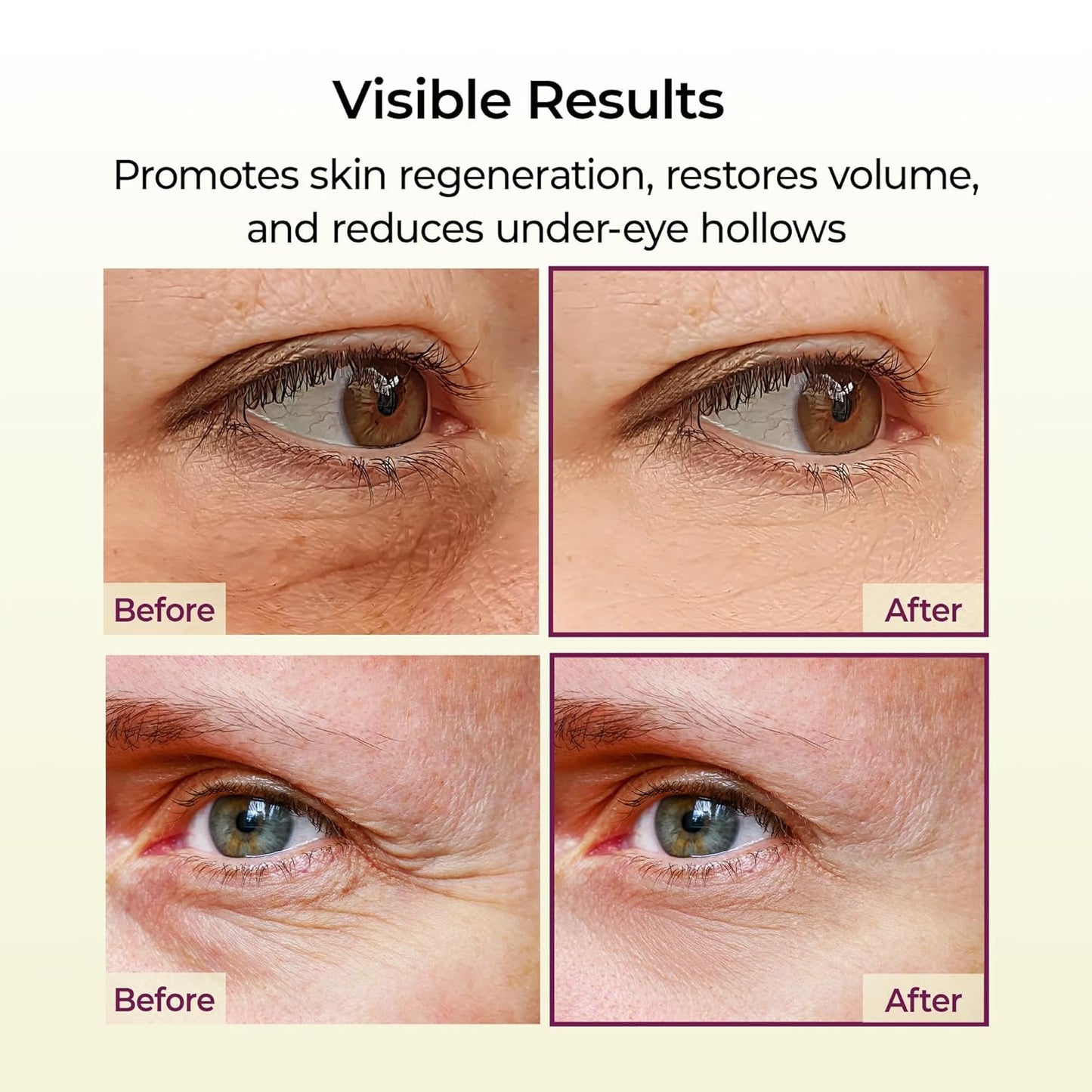 Calcium Multi Balm by MyVoora — Instant Lift & Glow