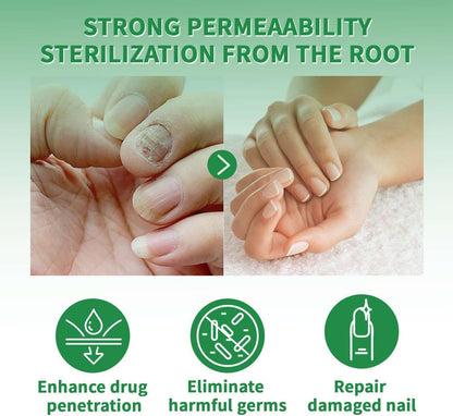 7 Days Nail Fungus Treatment Serum