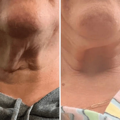 Roller Neck Cream Wrinkle Tightening