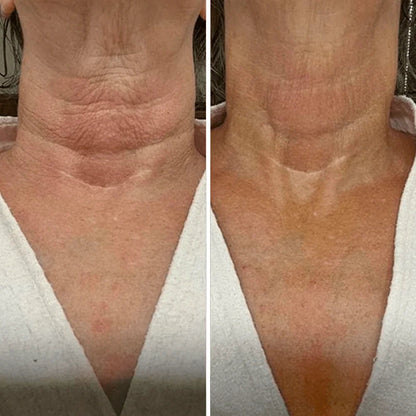 Roller Neck Cream Wrinkle Tightening