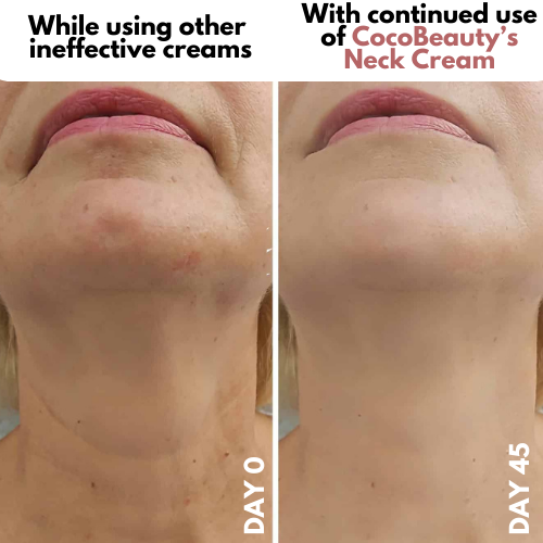 Roller Neck Cream Wrinkle Tightening