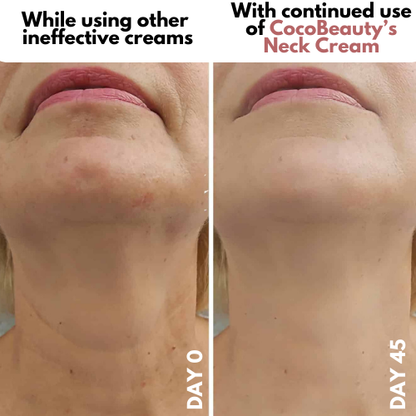 Roller Neck Cream Wrinkle Tightening