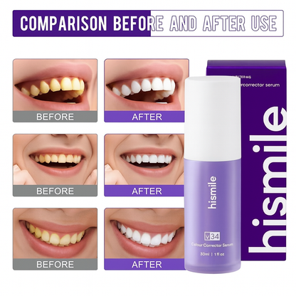 Teeth Brightening Serum V34