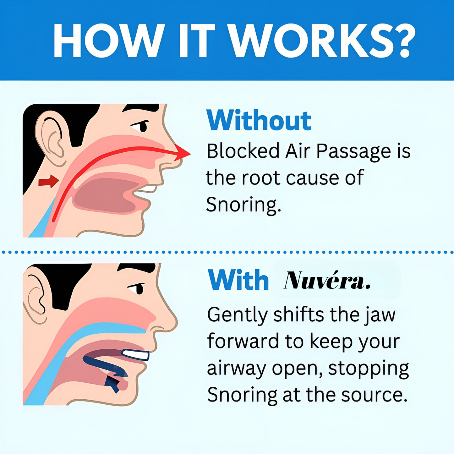 Anti Snoring MouthPiece