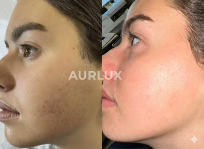 Cyperus Rotundus Skin Serum