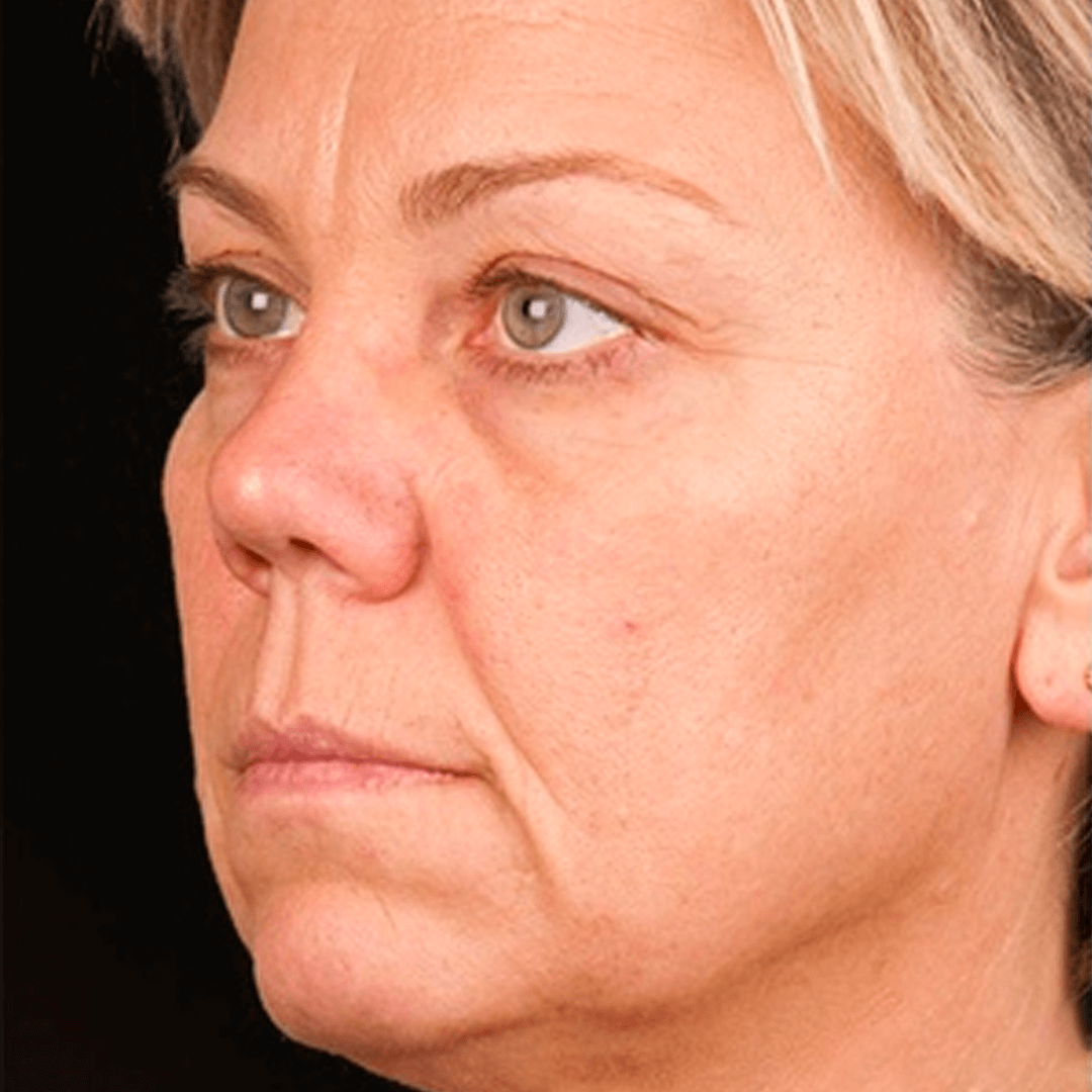 Facial Skincare Serum