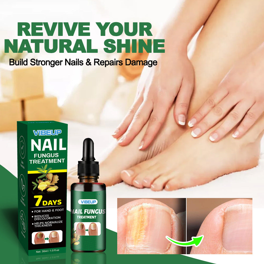 7 Days Nail Fungus Treatment Serum