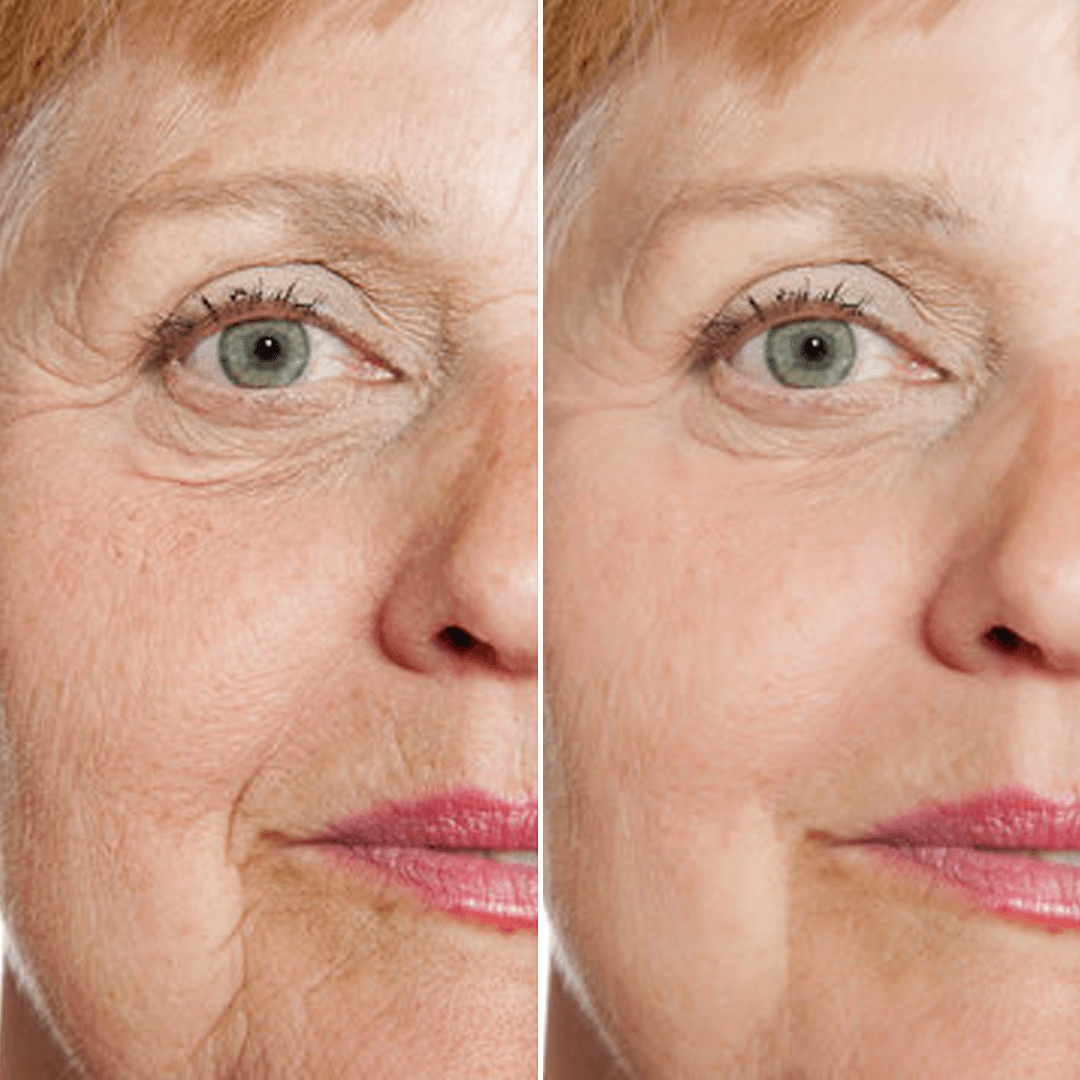 Facial Skincare Serum