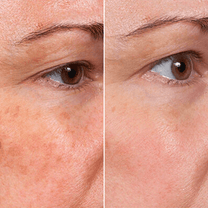 Facial Skincare Serum