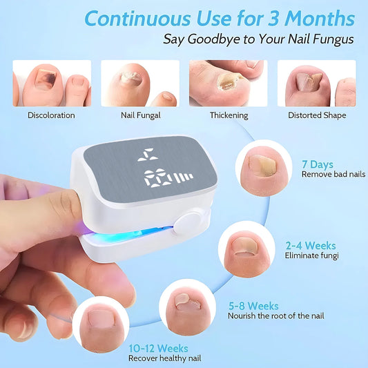 Nail Fungus Cleaning Laser Device