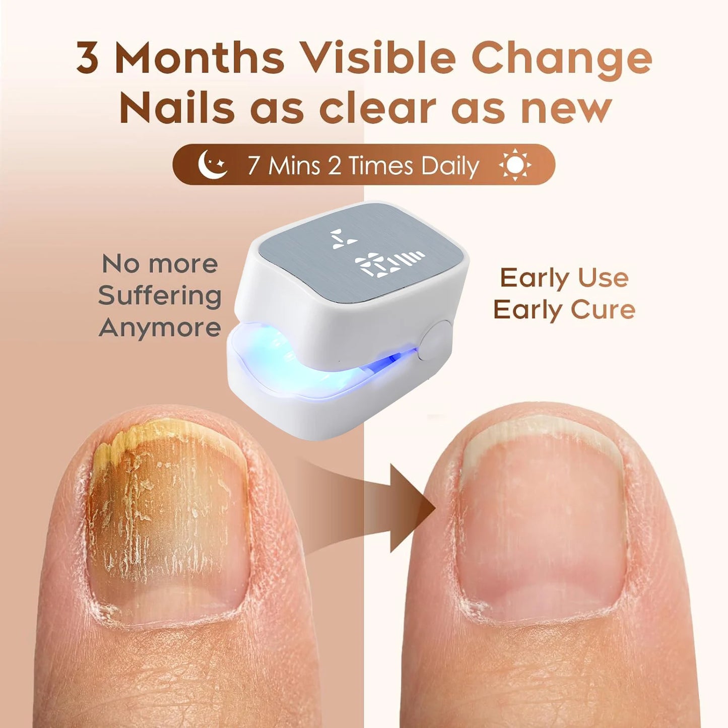 Nail Fungus Cleaning Laser Device
