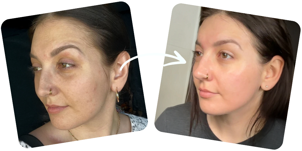 Seoul 1988 Anti-Aging