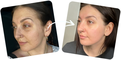 Seoul 1988 Anti-Aging