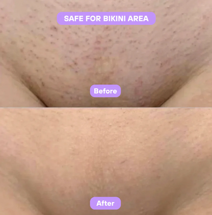 Cyperus Rotundus Skin Serum