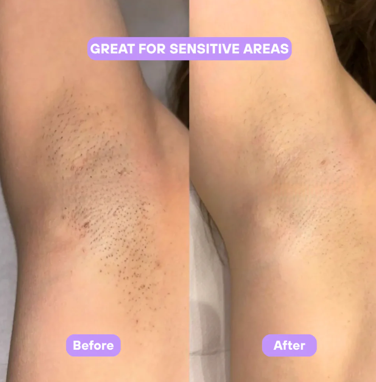 Cyperus Rotundus Skin Serum