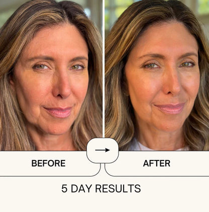 Organic Castor Oil Roll-On