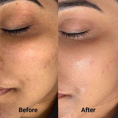 Foundation  Shade-Matching Companion