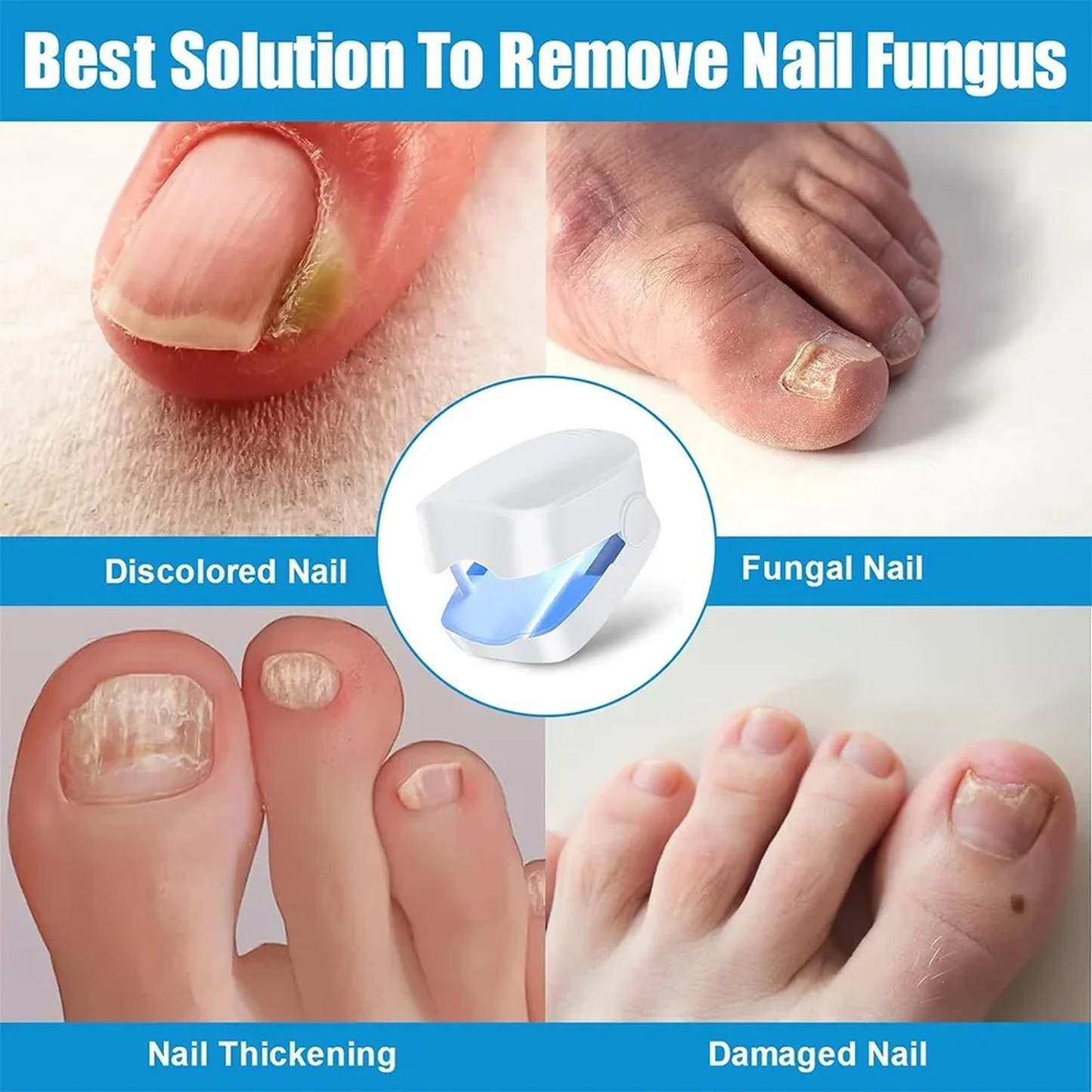 Nail Fungus Cleaning Laser Device