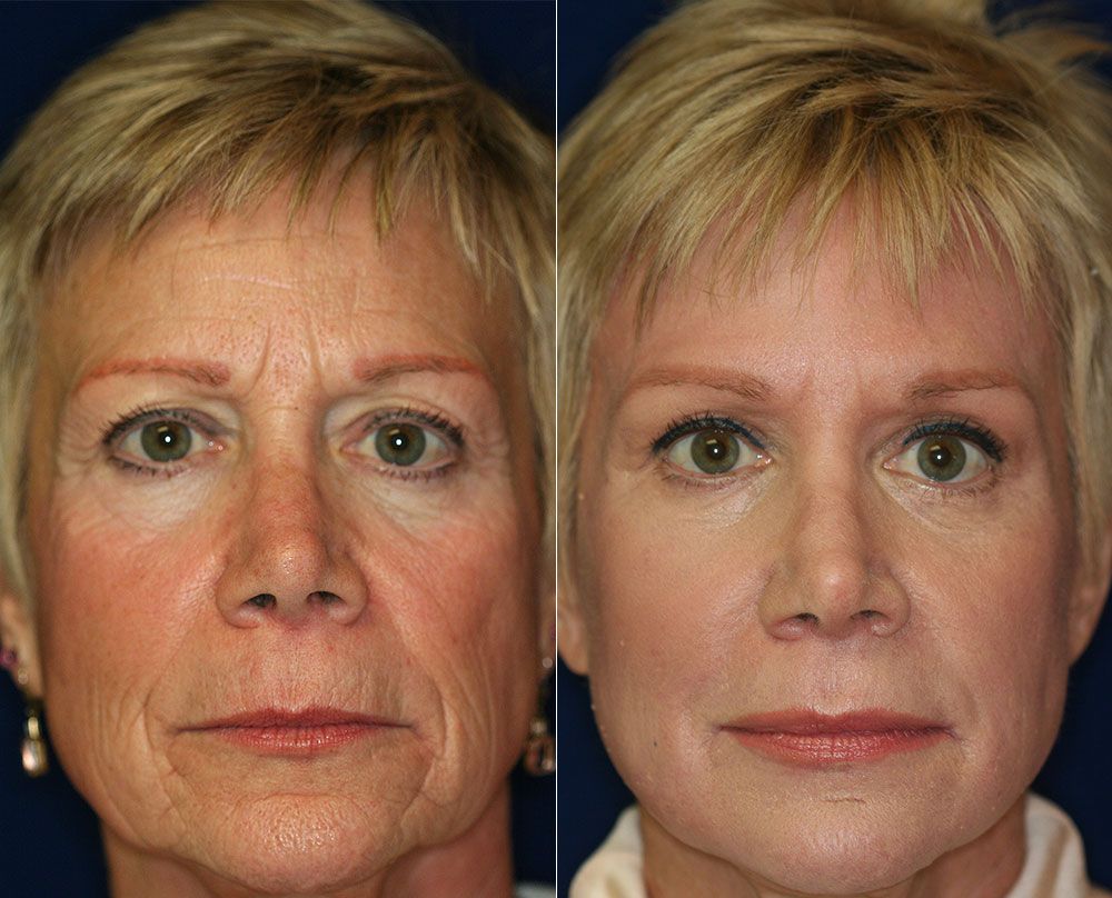 Organic Castor Oil Roll-On