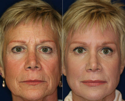 Organic Castor Oil Roll-On