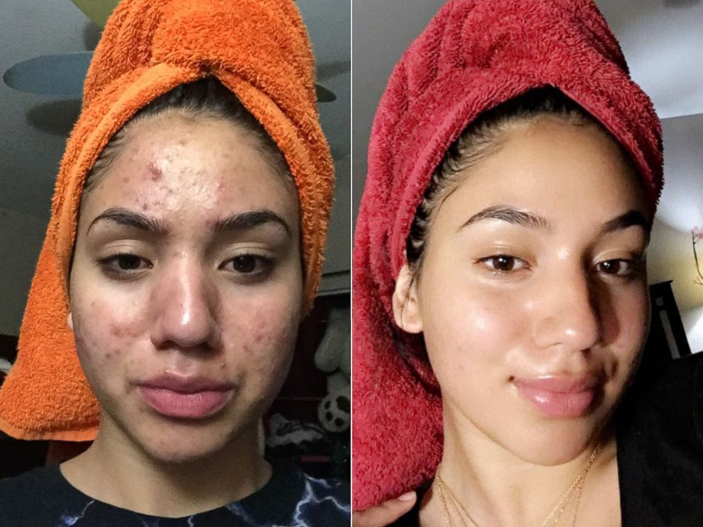 Dr. Melaxin Rice Skin Serum