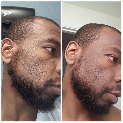 Dr. Melaxin Rice Skin Serum