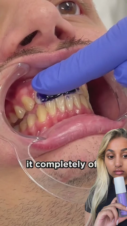 Teeth Brightening Serum V34