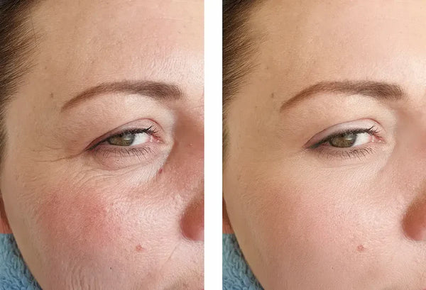 Seoul 1988 Anti-Aging