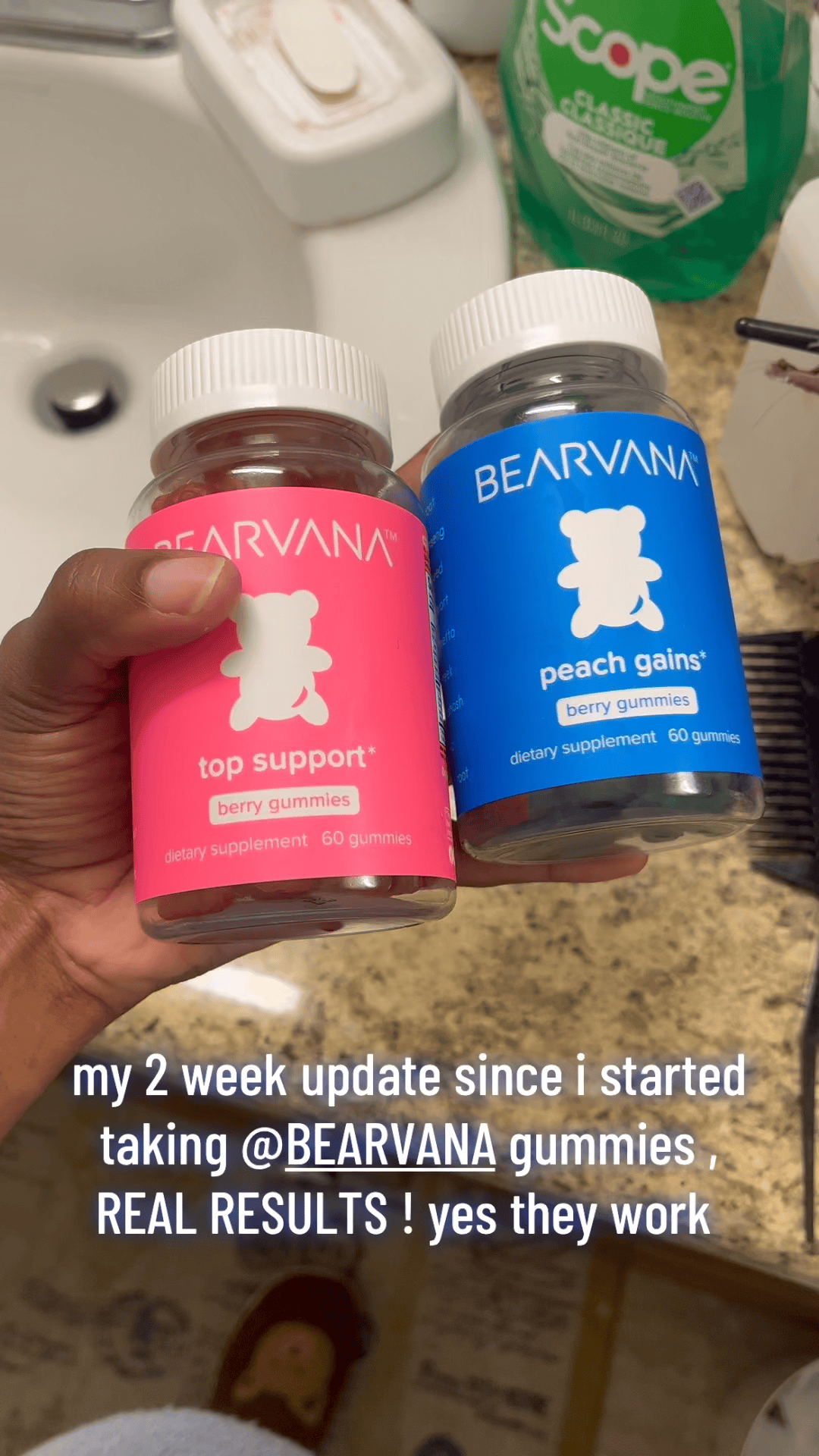 BabeShape Gummies